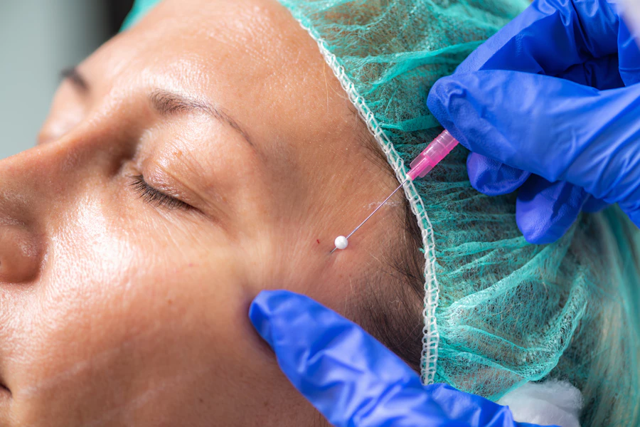 A client receiving an advanced facial rejuvenation procedure